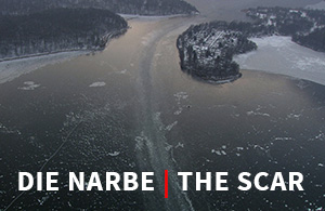 THE SCAR PROJECT / DAS NARBE PROJEKT by Burkhard von Harder